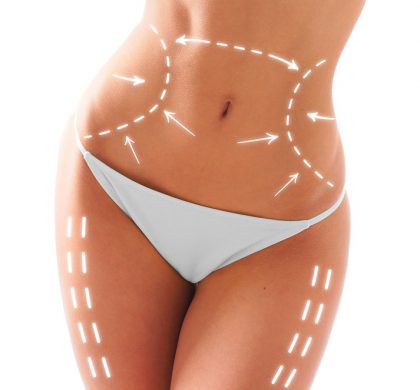 mesoterapia-corporal